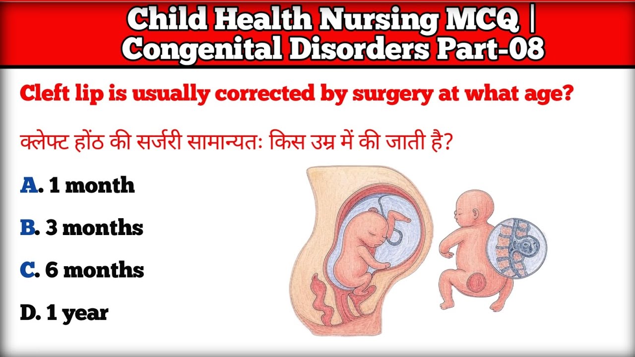 Staff Nurse Important Previous Year Questions | Child Health Nursing | AIIMS NORCET RRB CHO ESIC NHM