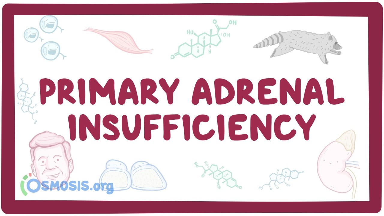 Primary adrenal insufficiency - pathology, symptoms, diagnosis, treatment
