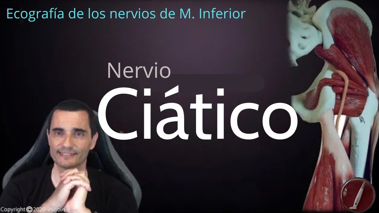 ECOGRAFÍA DE NERVIOS MIEMBRO INFERIOR (PARTE I) | Nervio Ciático y Región Subglútea