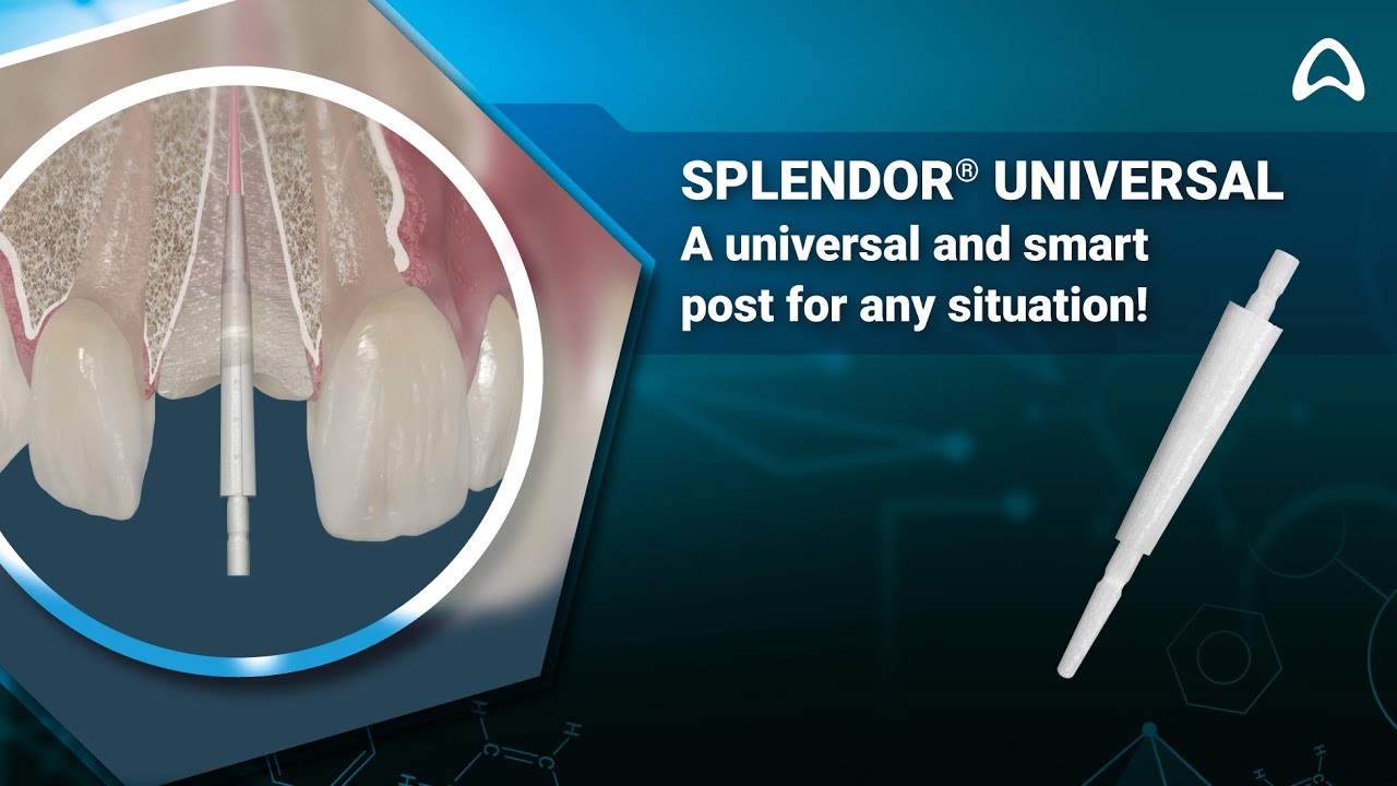 Splendor&reg; Universal - a smart post for any situation!