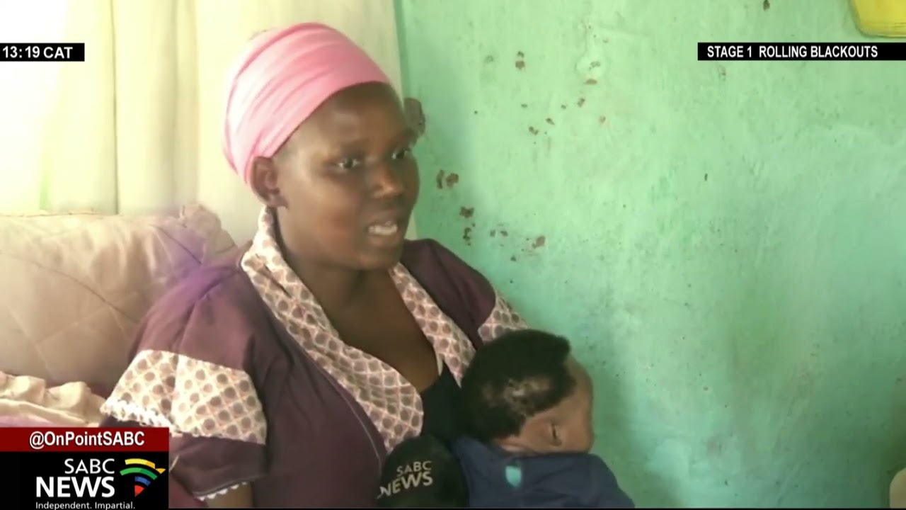 Ngqeleni and parts of Libode communities report cases of kwashiorkor