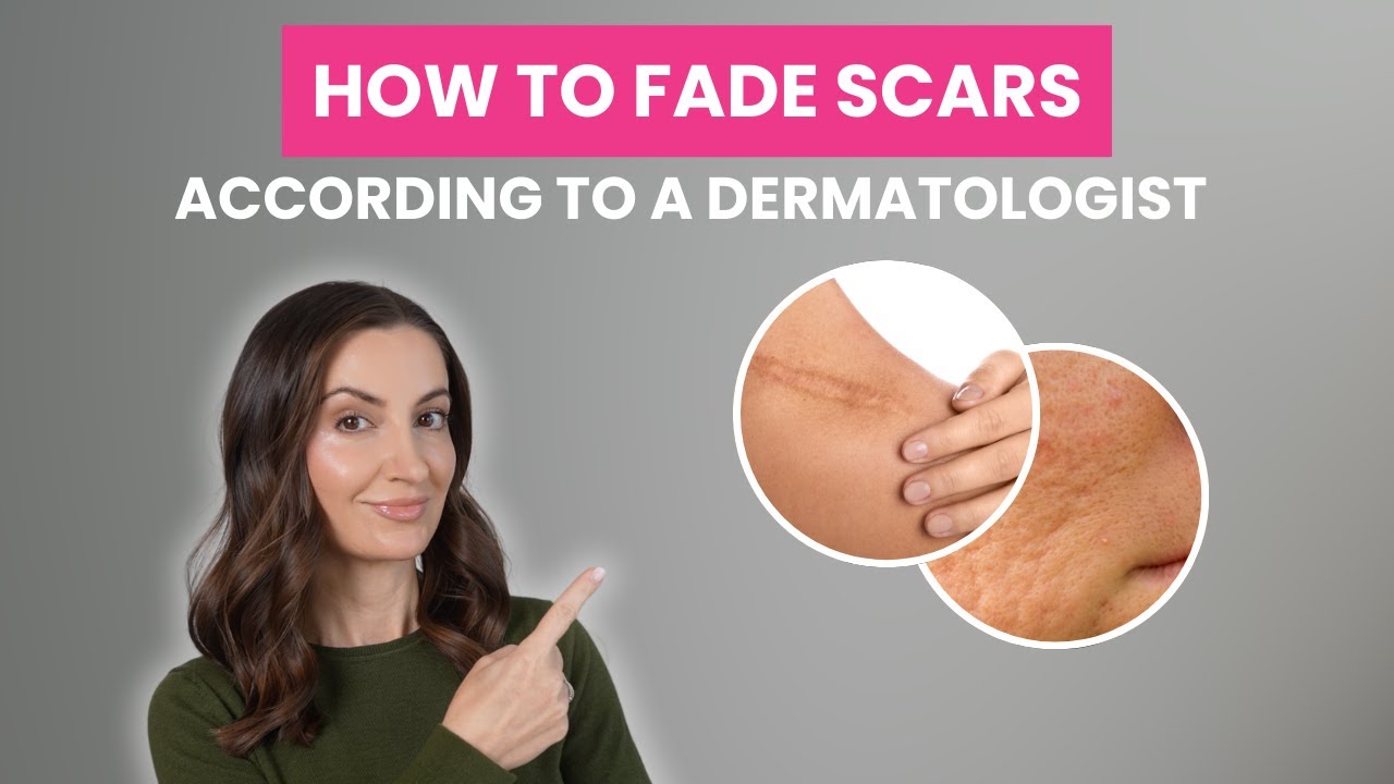 How to Treat Scars Like a Dermatologist | Acne Scars, Keloids, Dark Marks & More