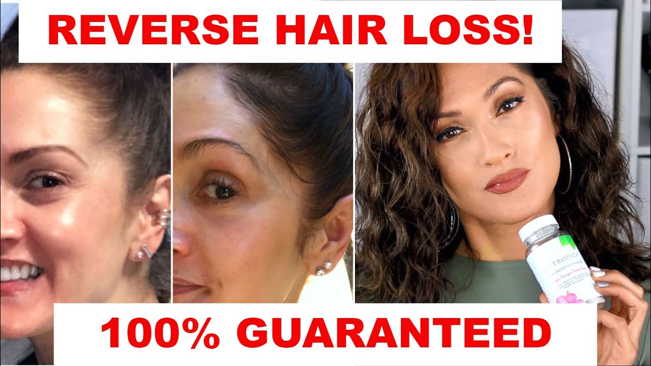 REVERSE HAIR LOSS IN 60 DAYS | GUARANTEED RESULTS!!!