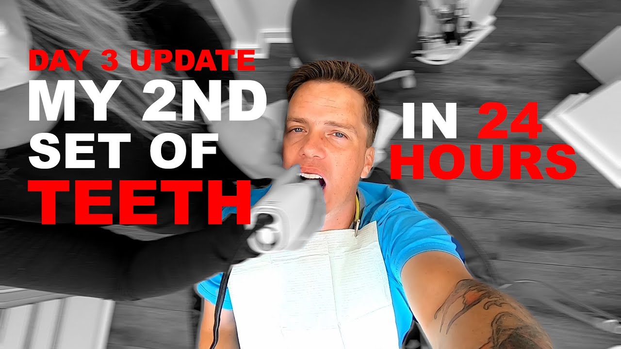 Trying New Teeth and Buying Some Furniture to Refinish in Florida - Part 3/4