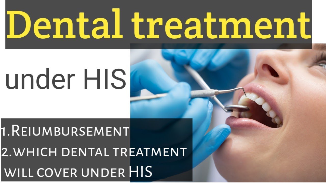 All about dental treatment under HIS in #tcs #dentaltreatments