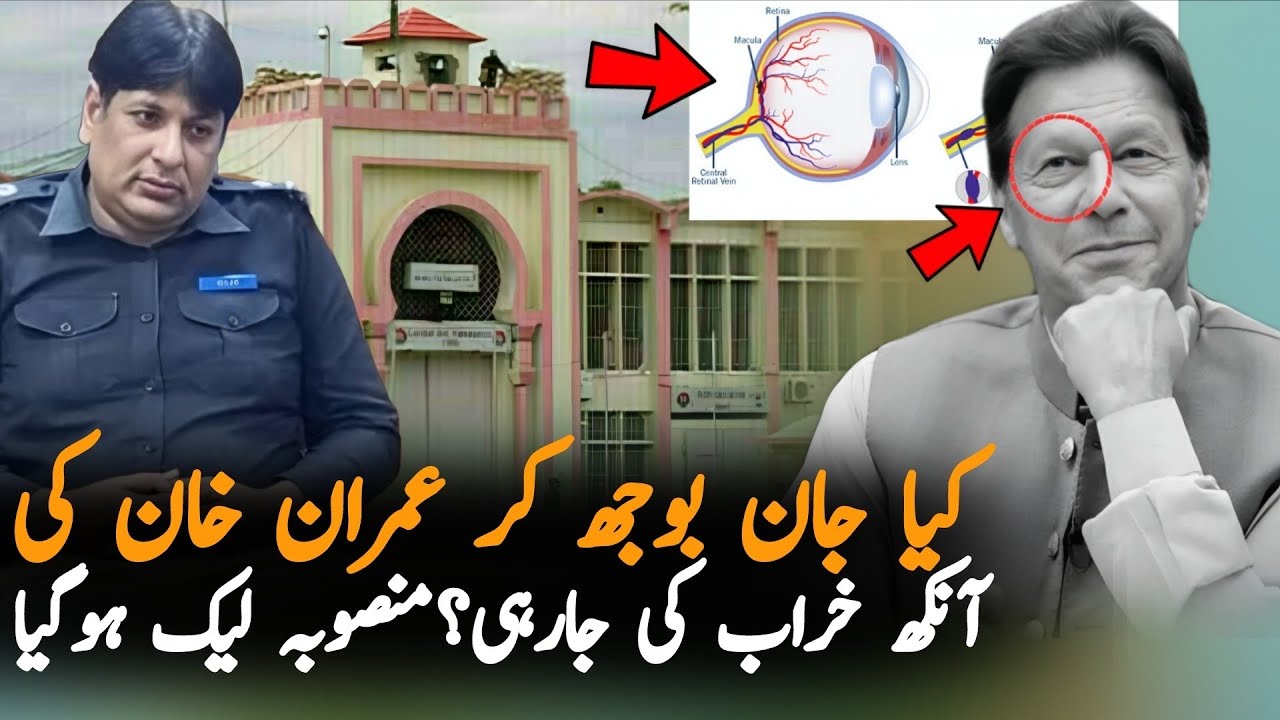 Why Imran Khan Eye Infection Is So Serious? New Govt Plan Behind This? | Latest Update