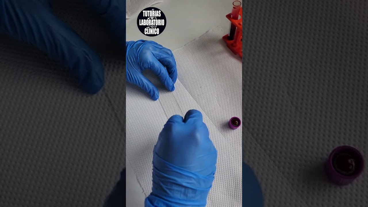 🩸&iquest;Como Hacer un FROTIS SANGU&Iacute;NEO Extendido de Sangre Perif&eacute;rica 🔬Tutorial Laboratorio Cl&iacute;nico P2