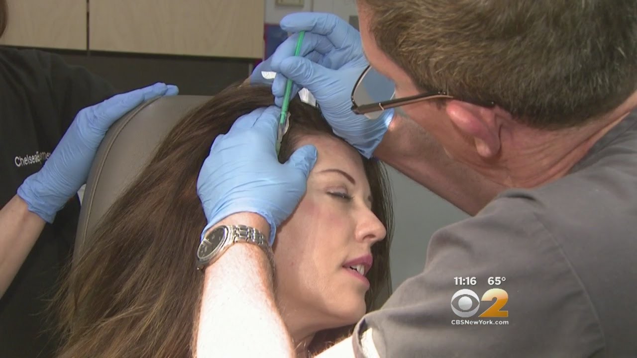 Seen At 11: Scalp Botox Shots