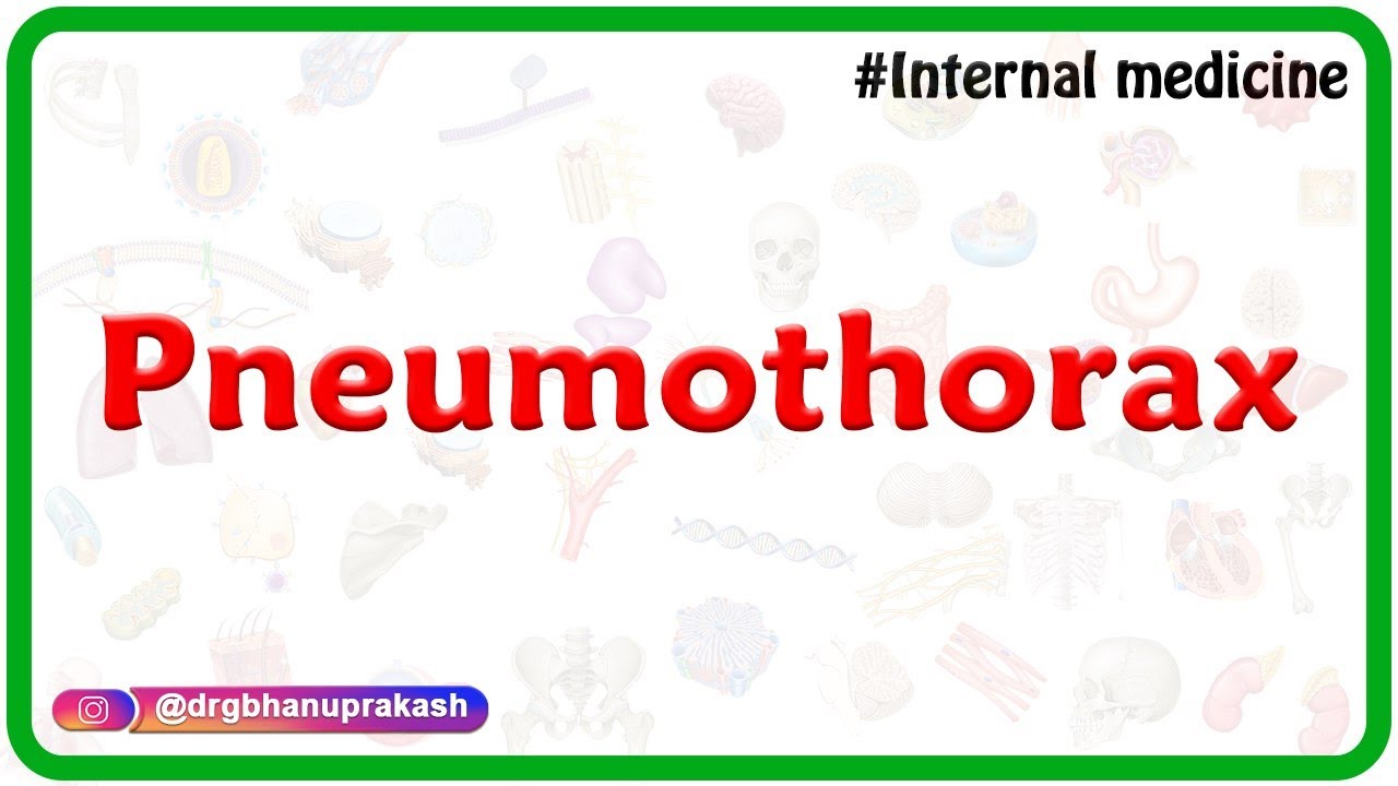 pneumothorax : Internal medicine lectures for FMGE and NEET PG : Dr Rajesh Gubba