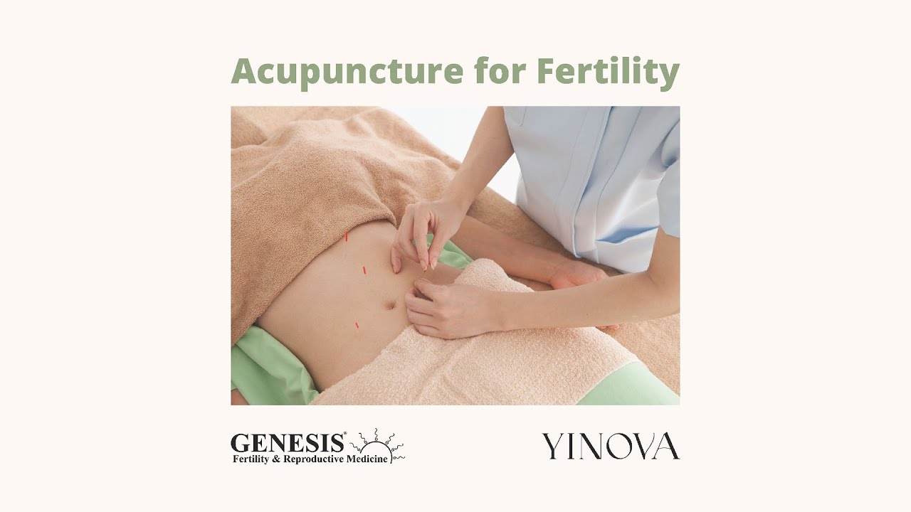 Acupuncture for Fertility