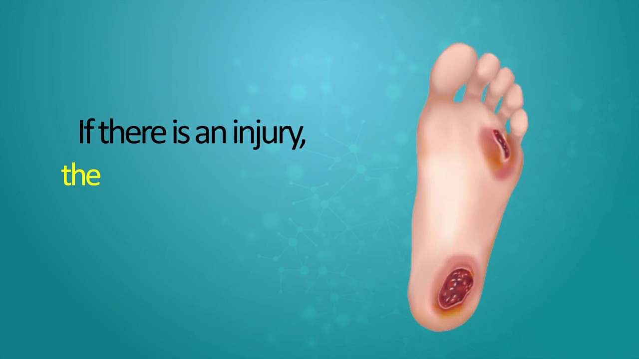 BETiC's Diabetic Foot Screener