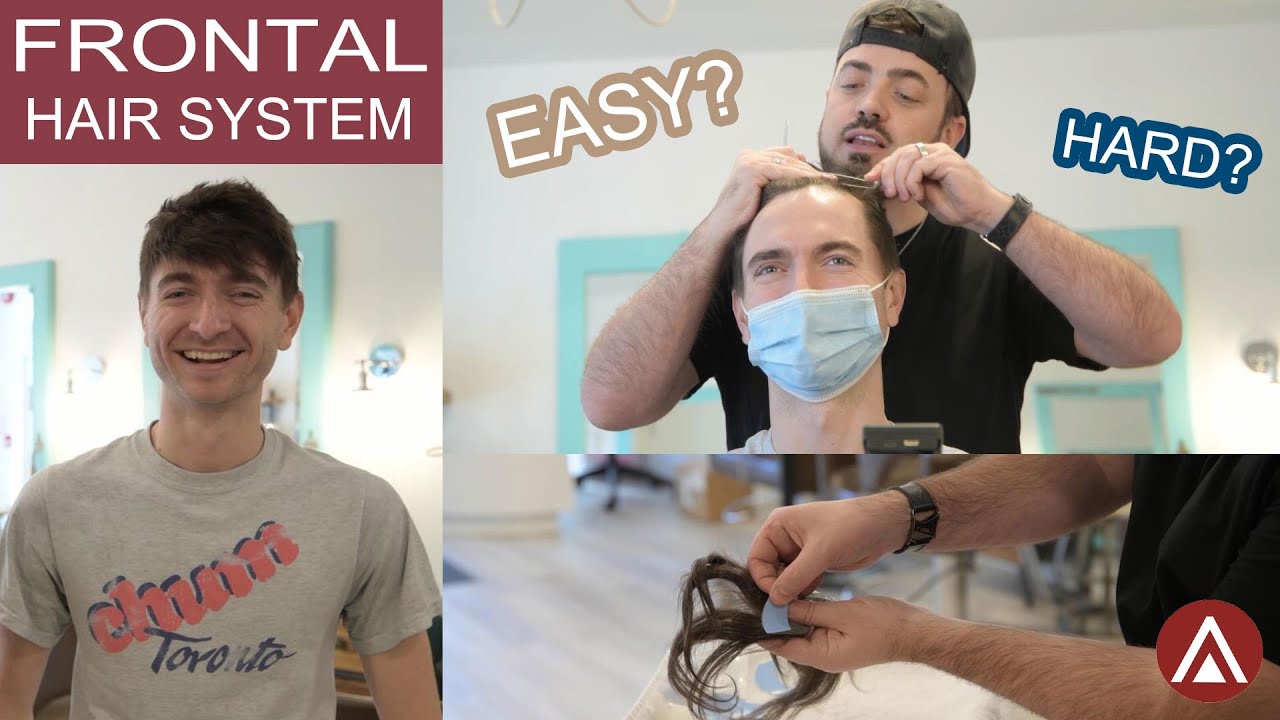 Hair System Tutorial: How Frontal Hairpieces Can Be Your Answer to a Receding Hairline | Lordhair