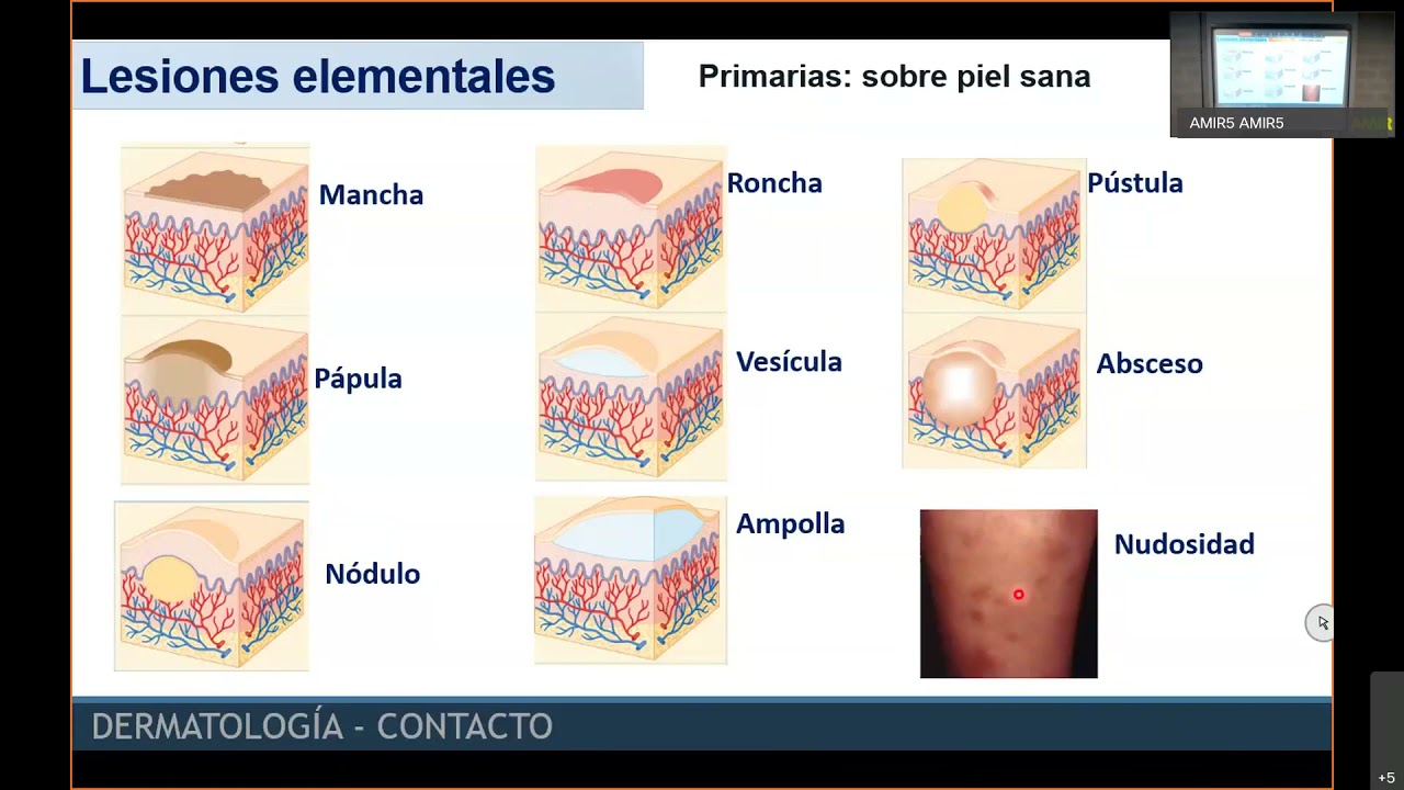 ENARM 2021 Dermatolog&iacute;a REVISI&Oacute;N DE TEMAS