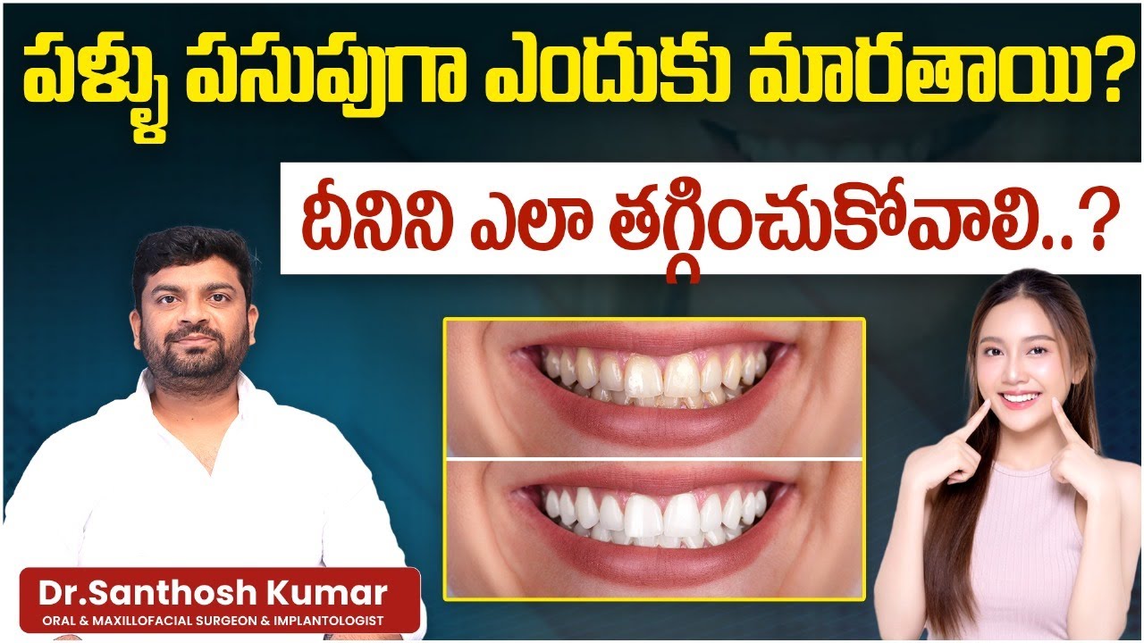 Why Do Teeth Turn Yellow and How to Reduce It | Causes and Solutions for Yellow Teeth | Eledent