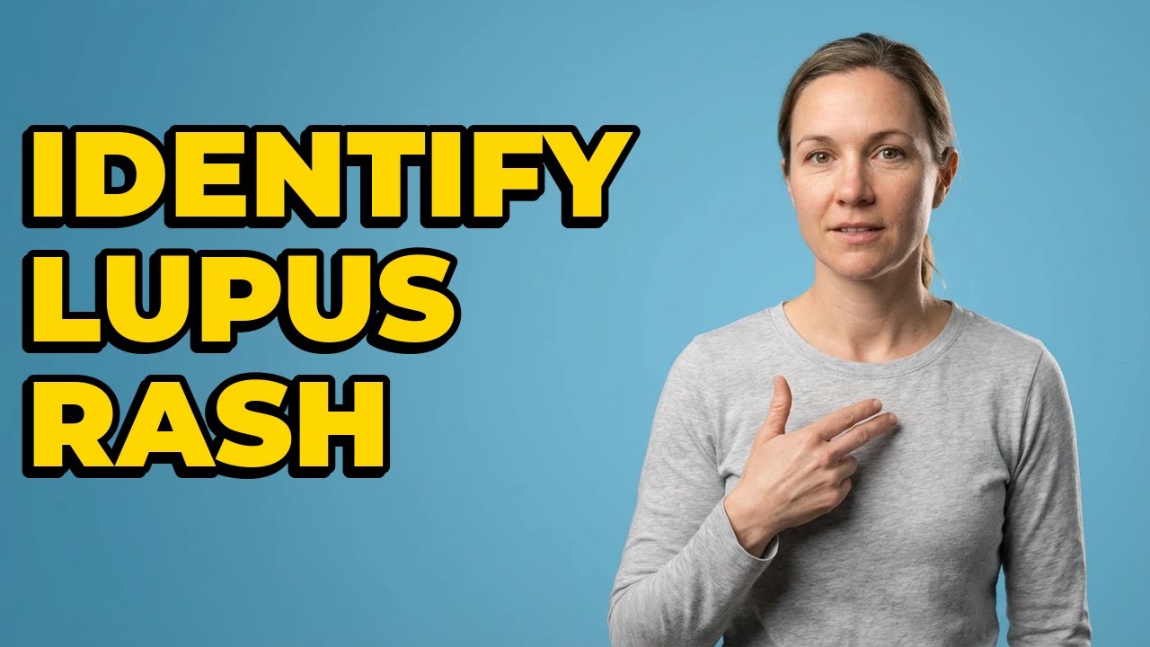 What Does the Lupus Malar Rash Look Like?
