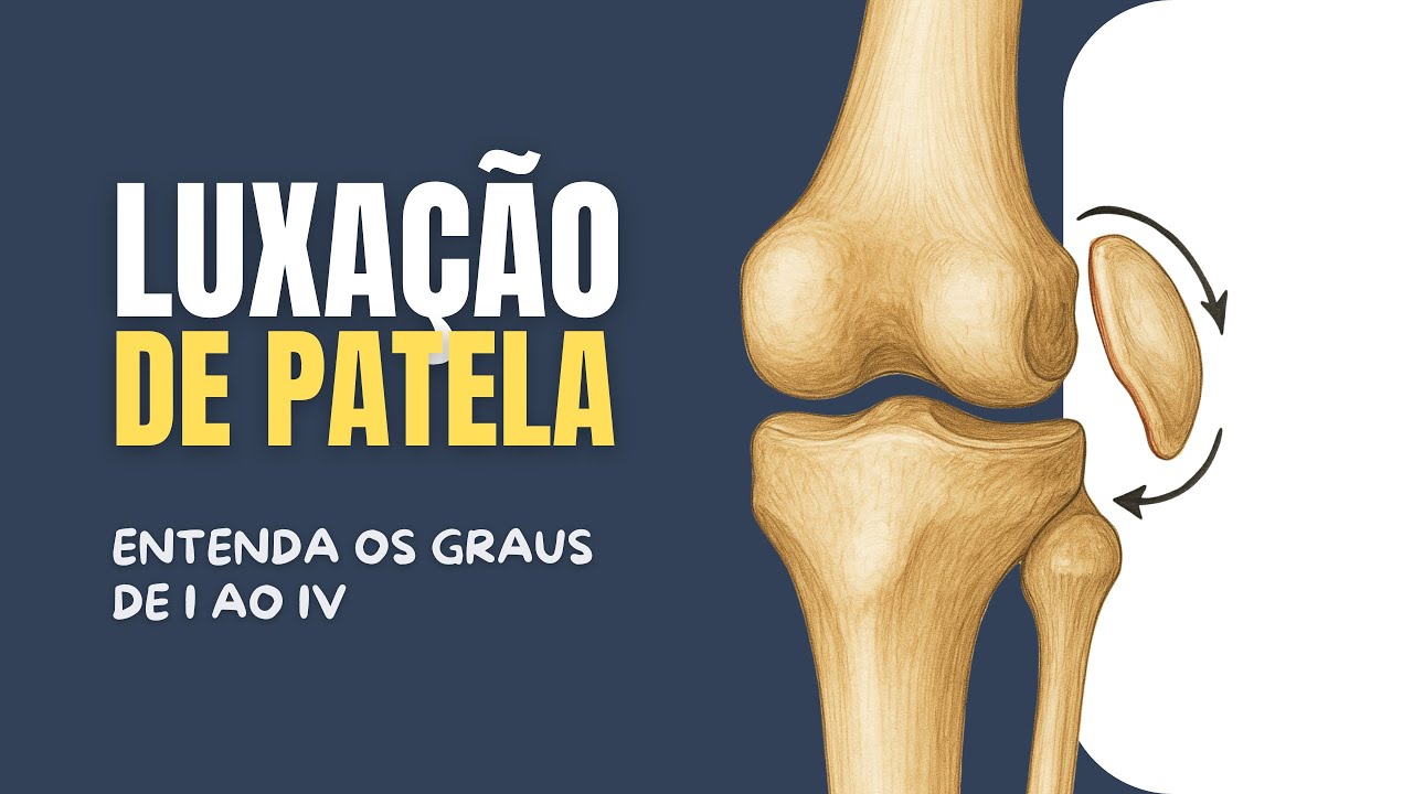 Graus de Luxação de Patela em Cães: Entenda com Exemplos