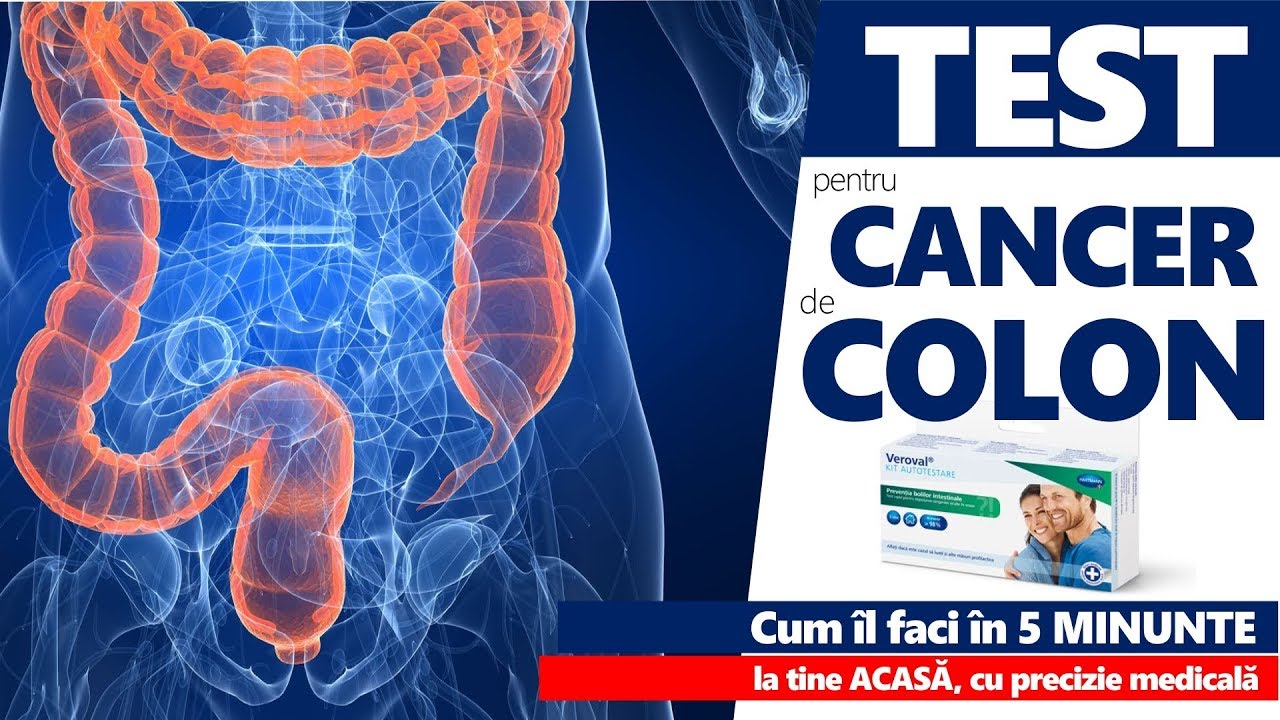 CANCER DE COLON ( cancer colorectal ). CUM SE FACE TESTUL hemocult care îl depistează