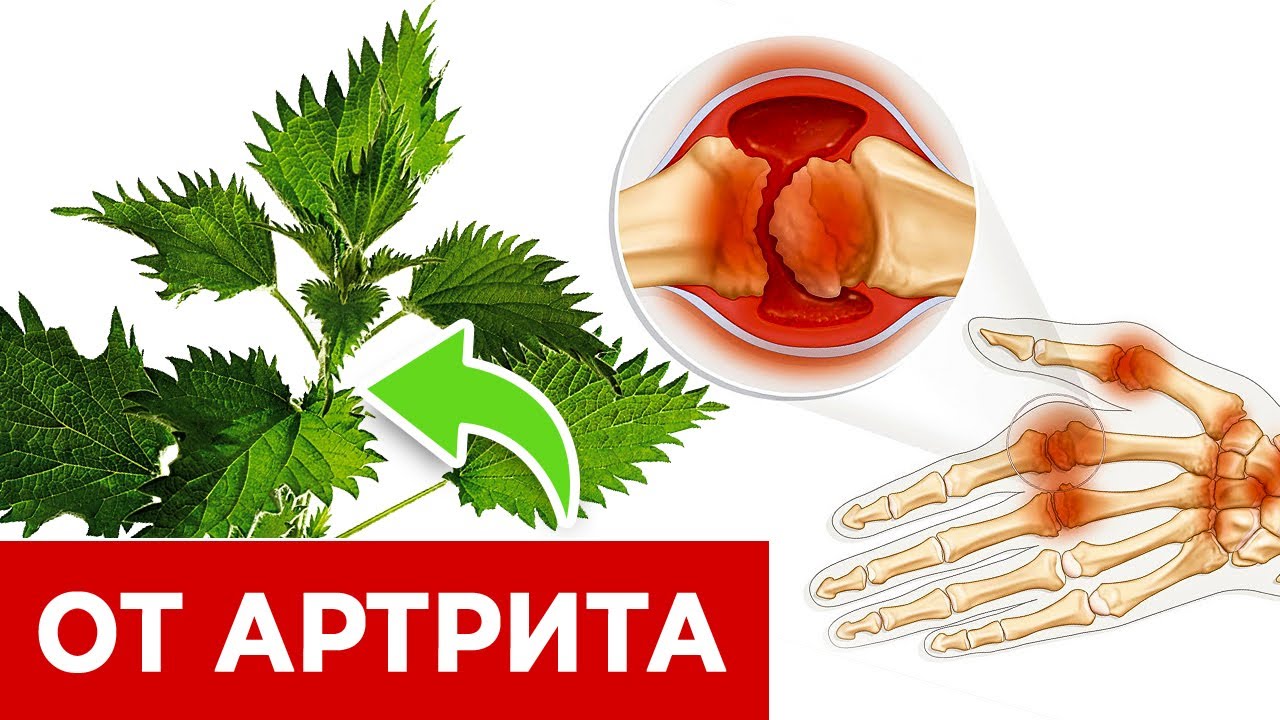 ЭТОТ сорняк ИЗБАВИТ вас от ВСЕХ болезней! Волшебное средство от боли в суставах, спине, мышцах!