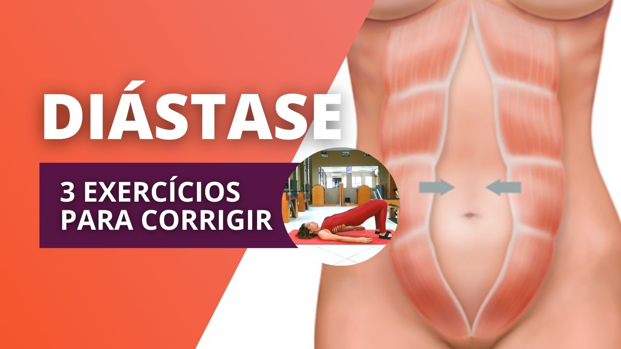 COMO CORRIGIR A DIÁSTASE com 3 EXERCÍCIOS em casa | Método Pilates