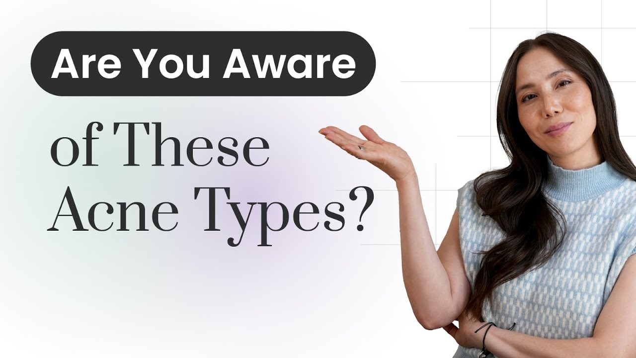 Understanding the Different Types of Acne & Triggers