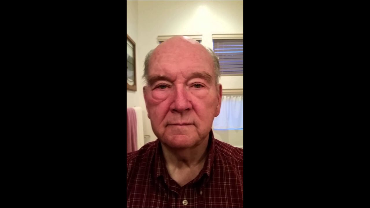 Jeunesse's Instant Ageless eye cream - Huge difference!