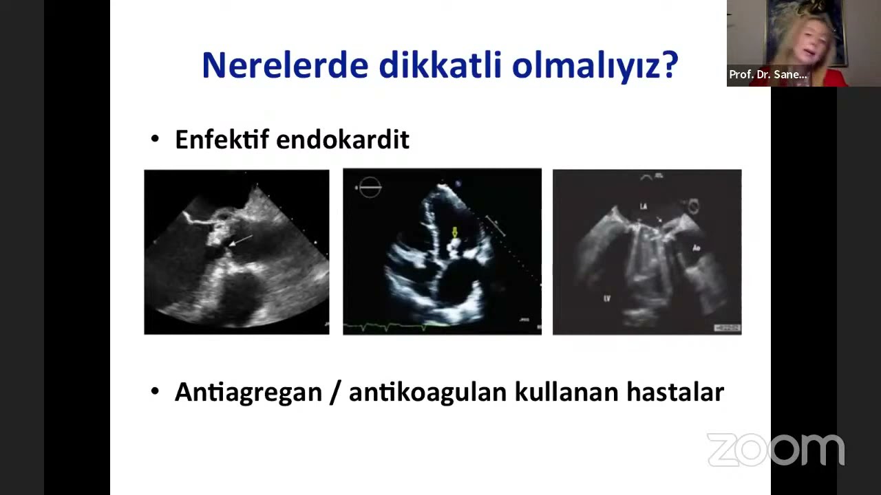 Kalp Hastalarında Diş Tedavisine Yaklaşım - Prof. Dr. Sanem Nalbantgil