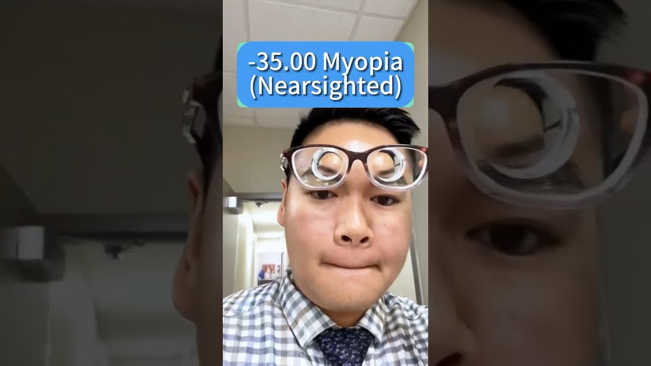 -35.00 D lense for Myopia or Nearsightedness&nbsp;#myopia&nbsp;#nearsighted&nbsp;#nearsightedness&nbsp;#glasses&nbsp;#elklook