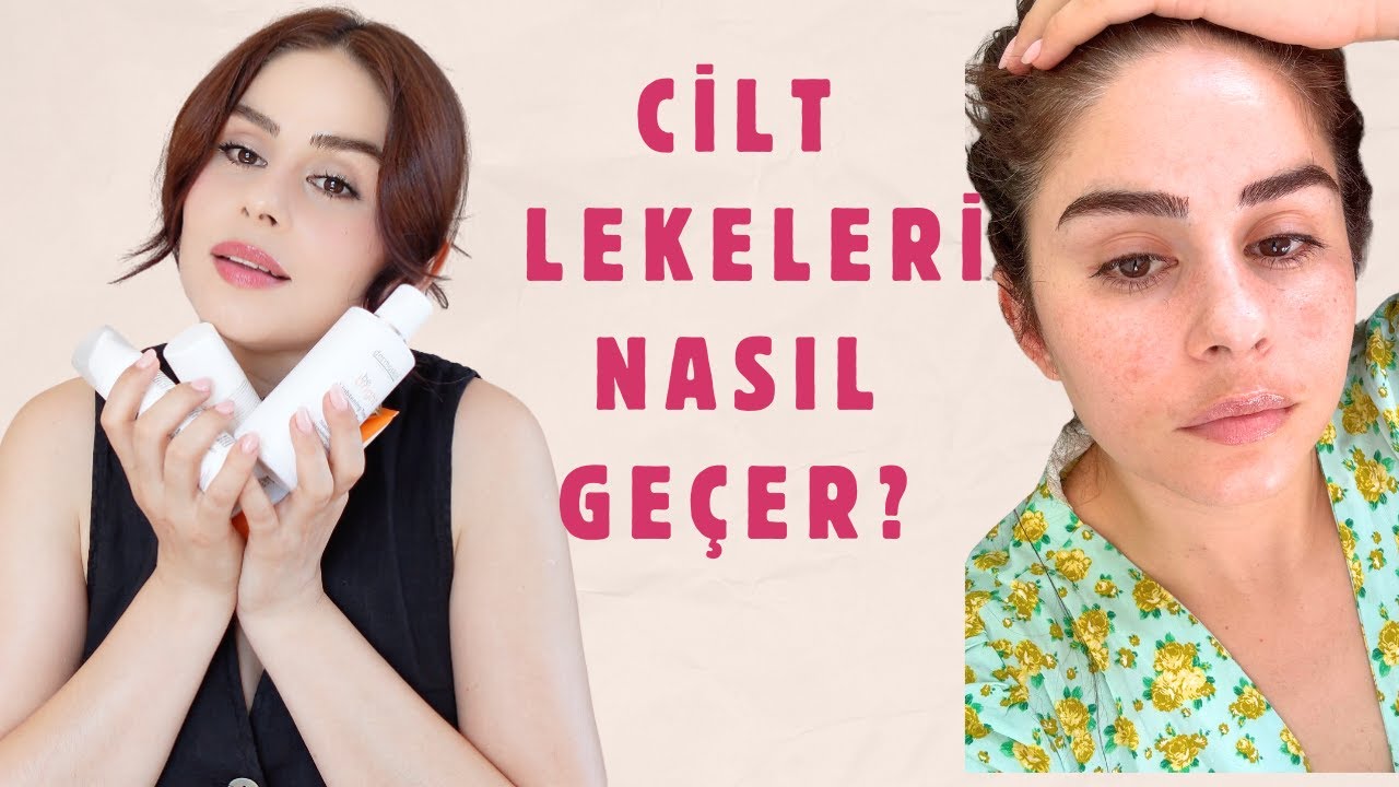 YAZIN LEKE Bakımı | Cilt lekeleri i&ccedil;in kullanılması gereken i&ccedil;erikler & &Ouml;rnek Rutin