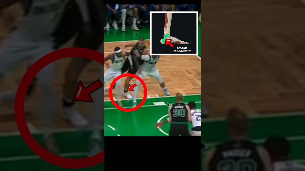 Кристапс Порзингис порвал что?? Врач объясняет! #nbafinals #анатомия