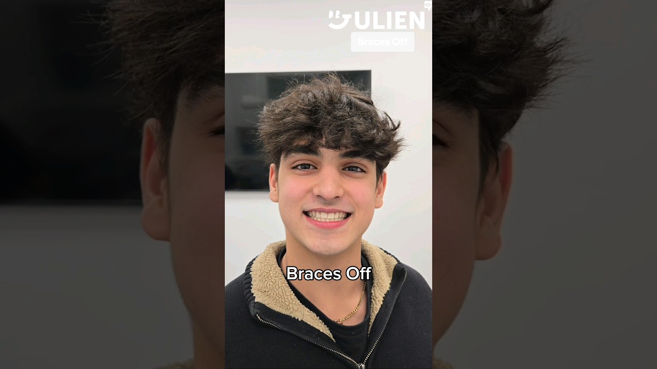 This is What You Get after 2 Years of Braces Pain