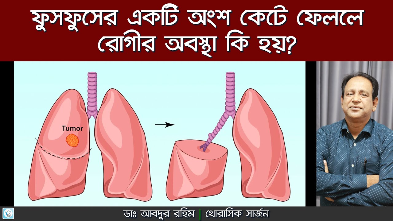 ফুসফুসের Lobectopmy operation কেন করা হয়? Lobectopmy করার পর কি রোগীর কোন অসুবিধা হয়?