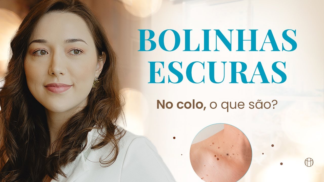 O que voc&ecirc; PRECISA saber sobre a DERMATOSE PAPULOSA NIGRA