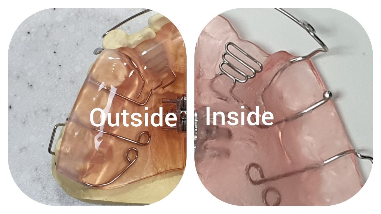 How to make a push spring /loop spring/Orthodontic appliance