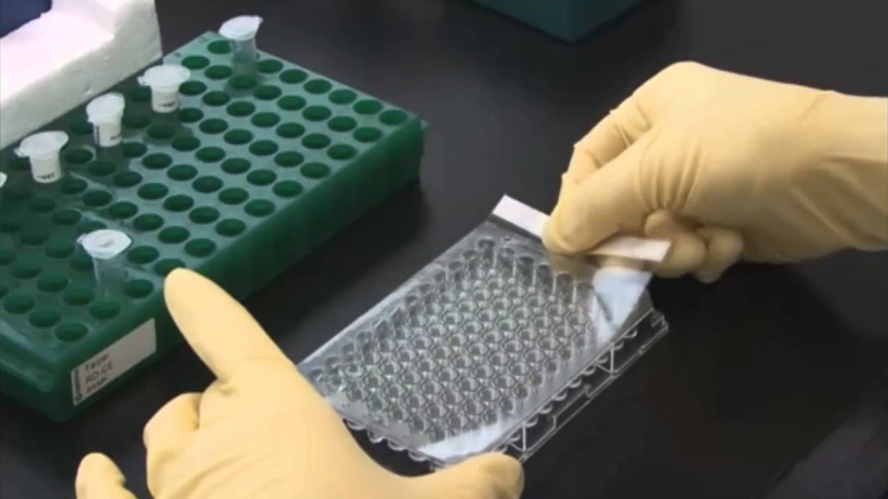 Determinaci&oacute;n de Hormona de Crecimiento por m&eacute;todo de ELISA indirecto