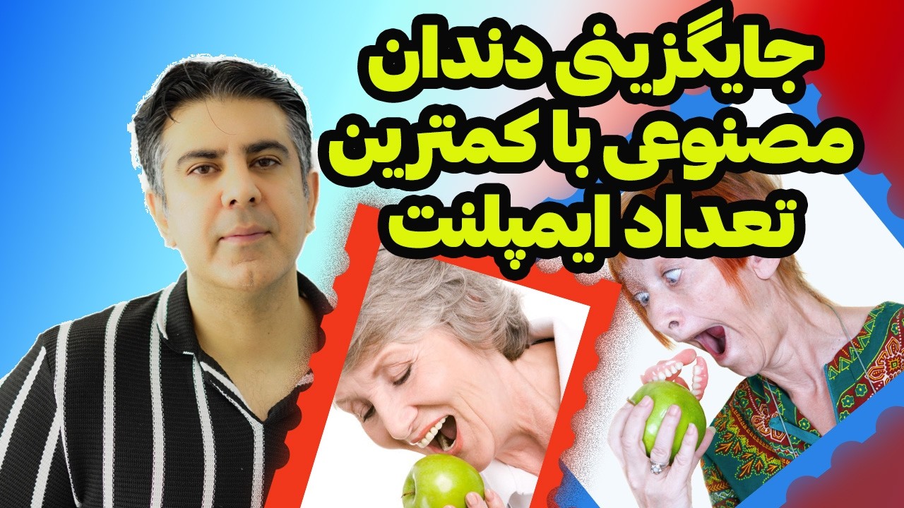 چگونه از مشکلات دندان مصنوعی خلاص شوید؟ راهنمای کامل اوردنچر متکی بر ایمپلنت