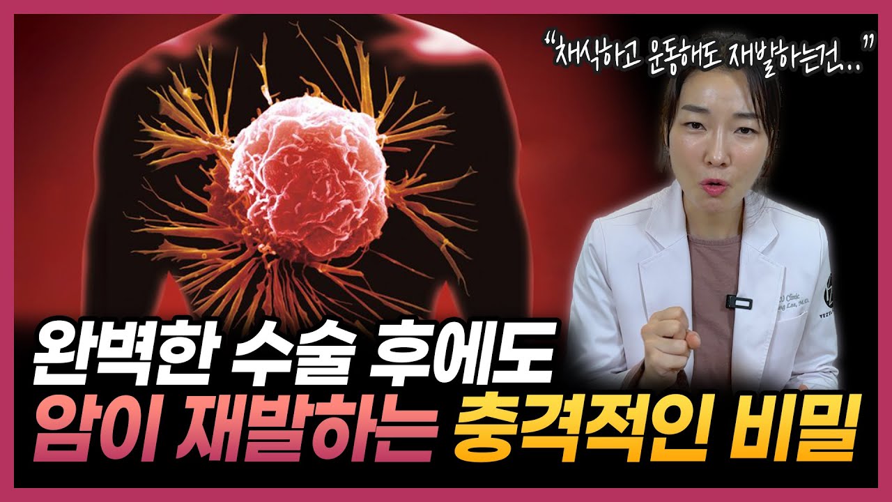 암 수술 후에도 숨겨진 위험... 전문의가 경고합니다 “암은 이렇게 재발됩니다”