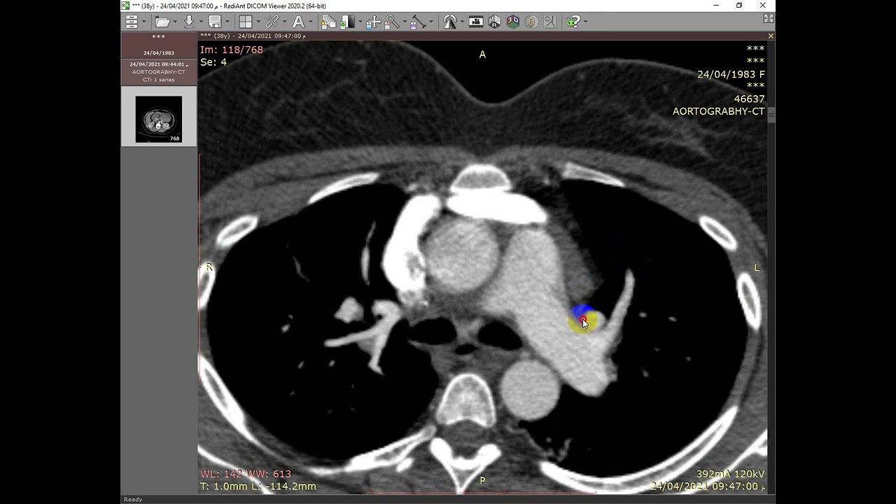 chest challenging cases 1