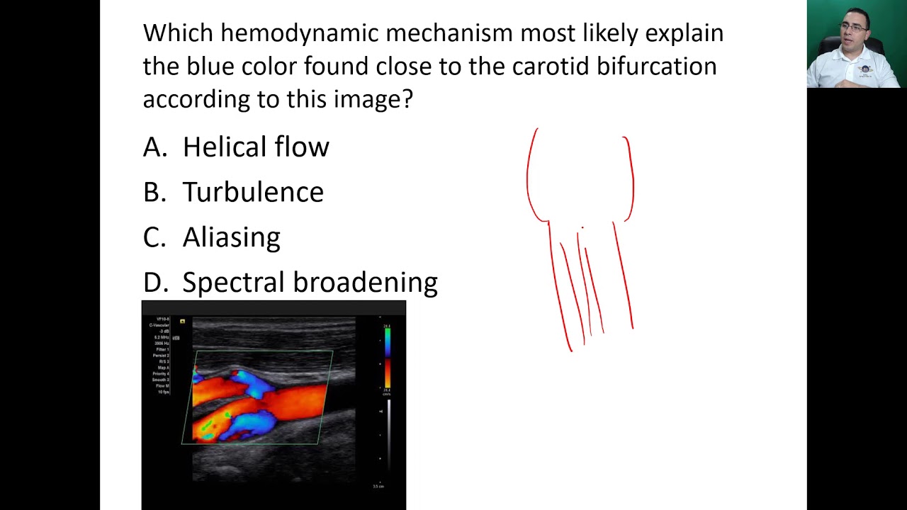 Cerebrovascular  Questions and Answers