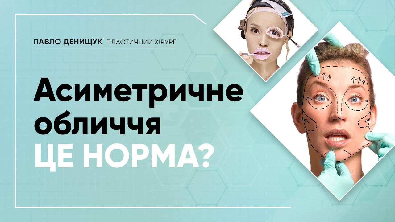 АСИМЕТРИЯ ЛИЦА — ЭТО НОРМА? КАК ИСПРАВИТЬ?
