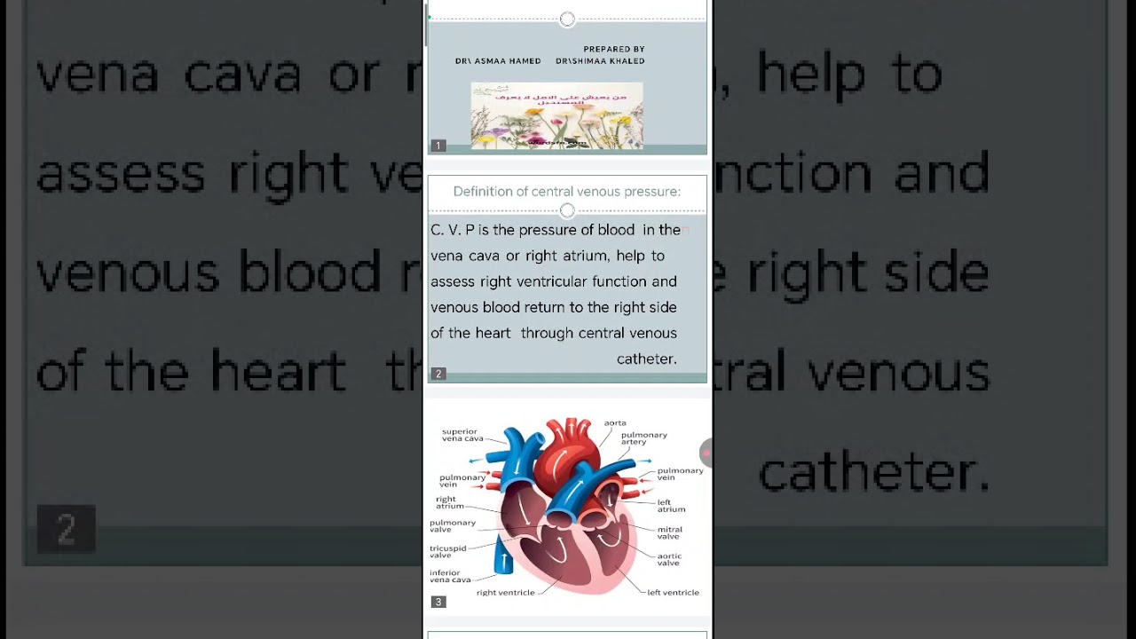 شرح ال (C. V. P)