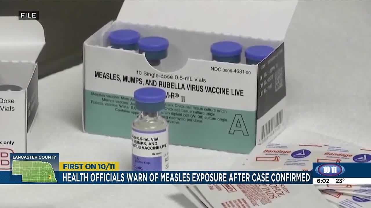 Health department warns of possible measles exposure after case confirmed in Lancaster County