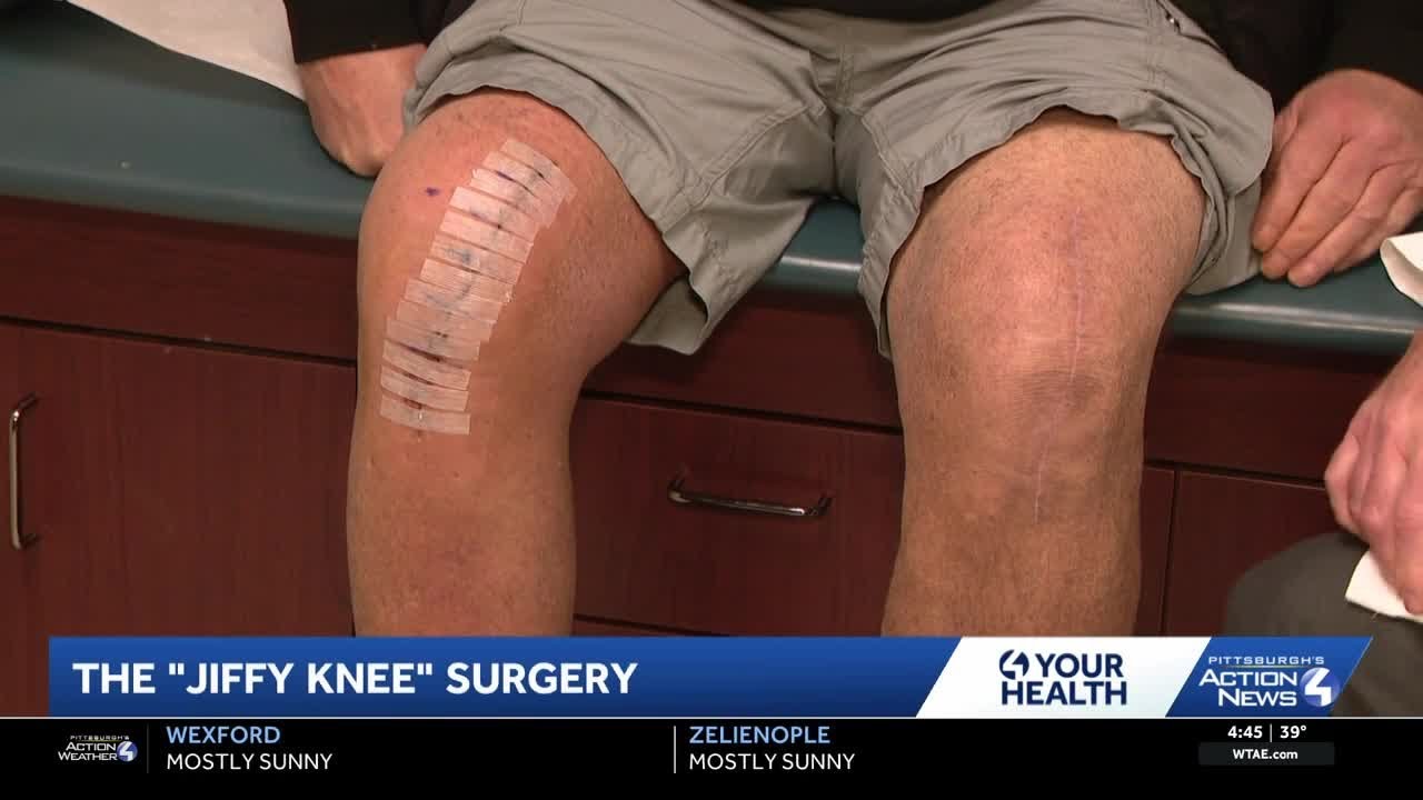 Хирургическое вмешательство Jiffy Knee обеспечивает более быстрое выздоровление пациентам в Запад...