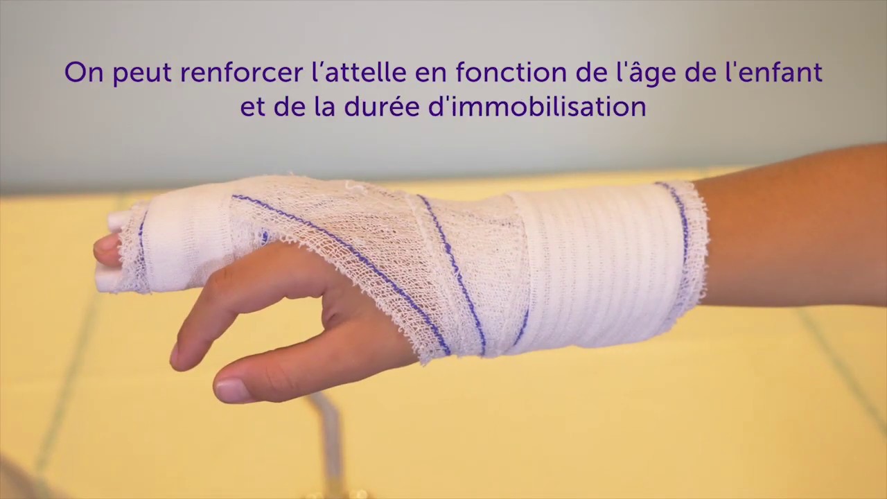Attelle Intrinsèque plus