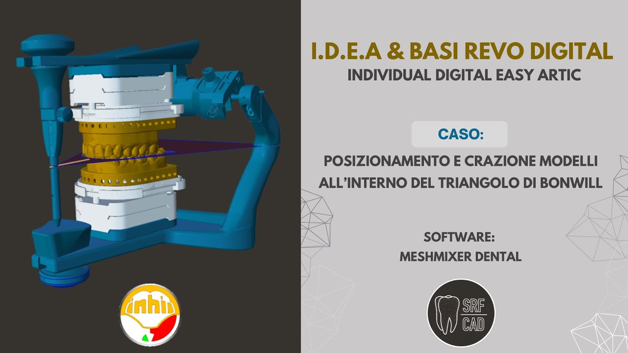 MESHMIXER DENTAL: IDEA REVO DIGITAL  TUTORIAL SCANSIONI INTRAORALI NEL TRIANGOLO DI BONWILL ARTEX