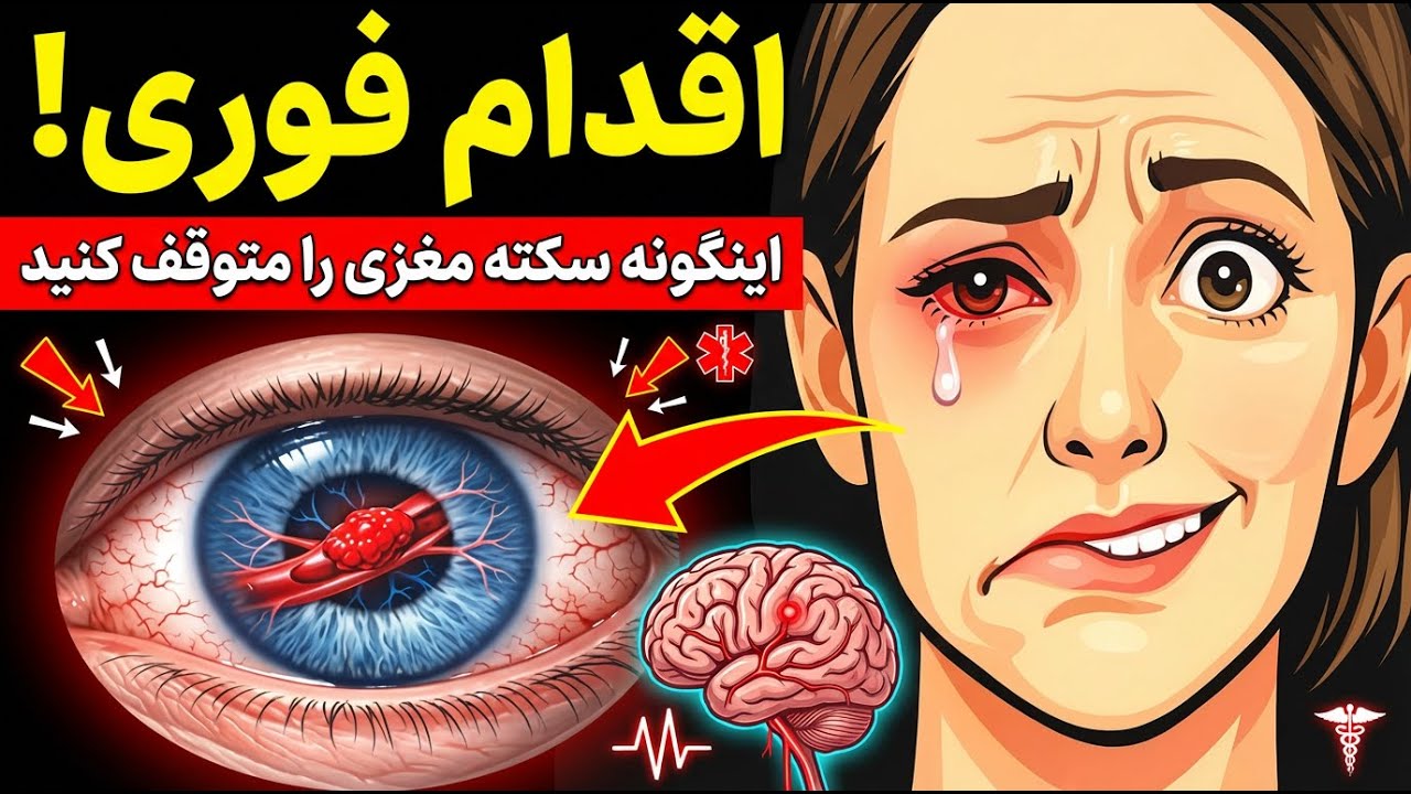 سکتهٔ مغزی: چگونه مغزت را در ۴ ساعت نجات دهی (این کار را انجام بده)