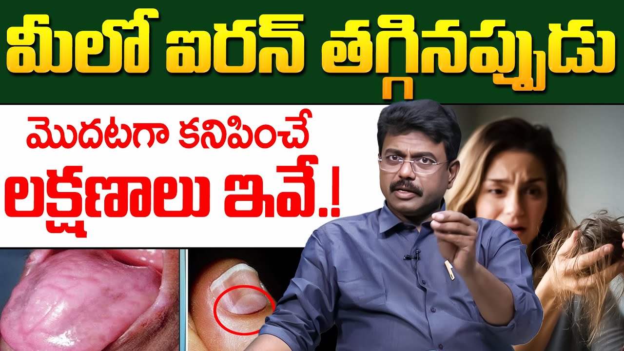 Iron Deficiency | శరీరంలో ఐరన్ తగ్గినప్పుడు కనిపించే మొదటి లక్షణాలు ఇవే.! | Dr Rajesh | iDream
