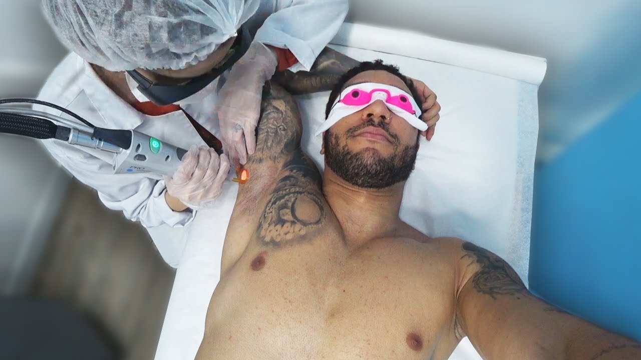 FIZ DEPILAÇÃO A LASER!!! [ DOEU MUITO? ]