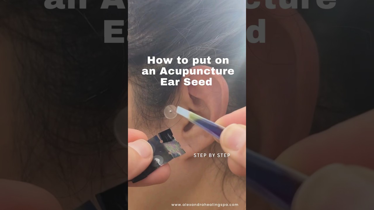 How to put on an acupuncture ear SEED #earacupuncture #acupuncture #naturalhealing
