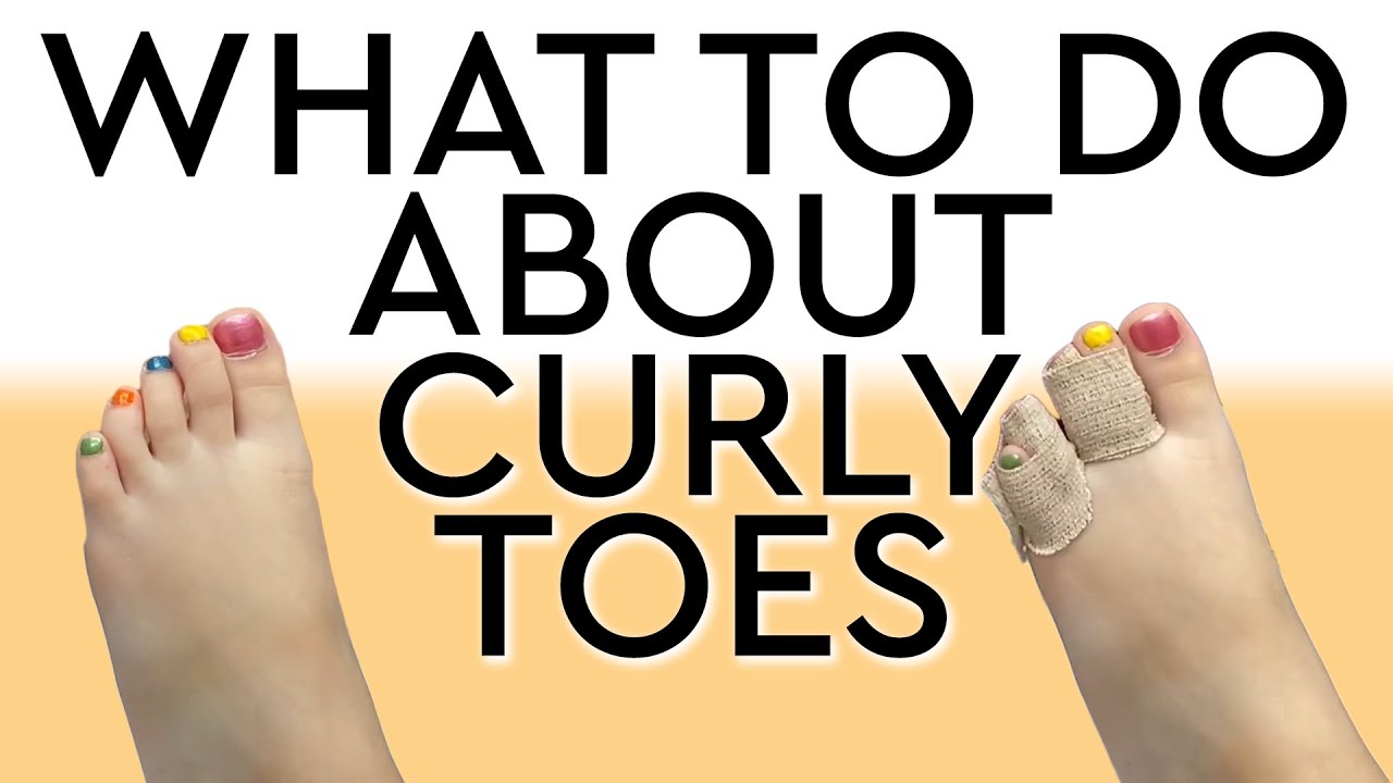 How To Deal with Curled Toes