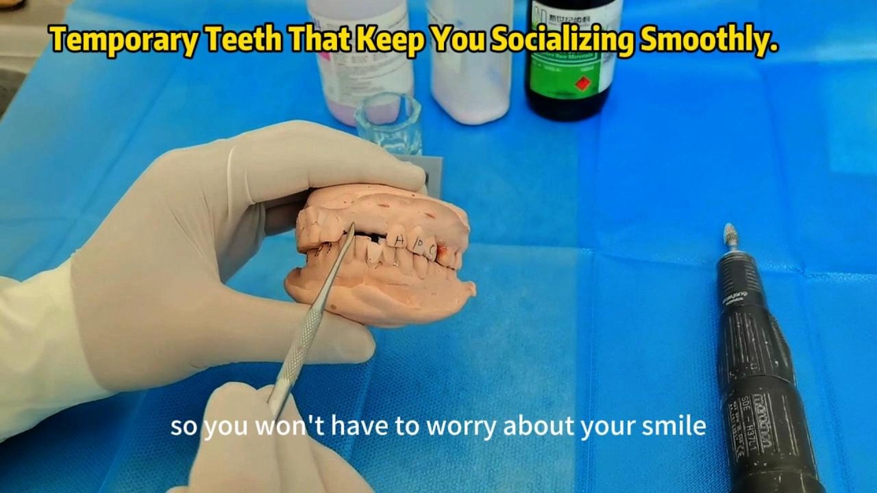 Easy-to-Make Partial Denture#DentalTech#Dentistry#PartialDenture